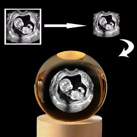 Custom 3D Crystal Ball with Baby Ultrasound – Personalized Pregnancy Keepsake Gift